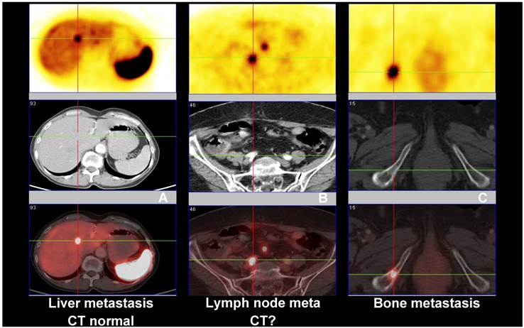 Theranostics Image