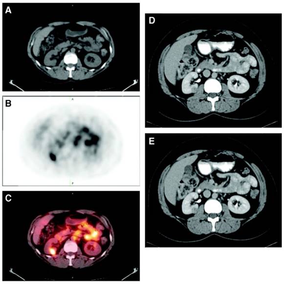 Theranostics Image