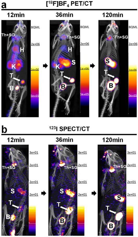 Theranostics Image