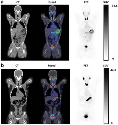 Theranostics Image