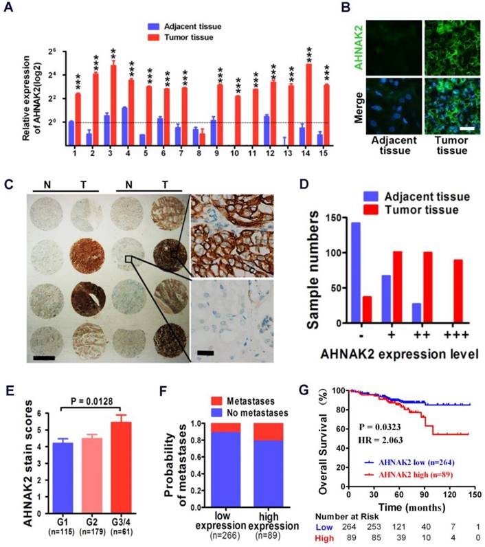 AHNAK2 Is A Novel Prognostic Marker And Oncogenic Protein For Clear