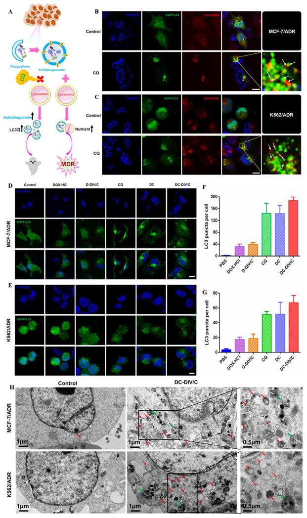 Drug Induced Self Assembled Nanovesicles For Doxorubicin Resistance