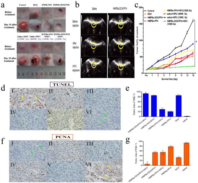 Theranostics Image