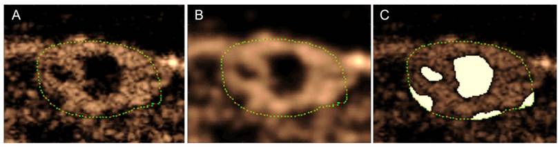 Theranostics Image