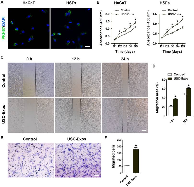 Exosomal DMBT1 from human urine-derived stem cells facilitates