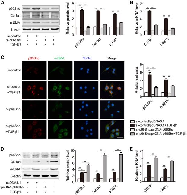 p66Shc Contributes to Liver Fibrosis through the Regulation of ...