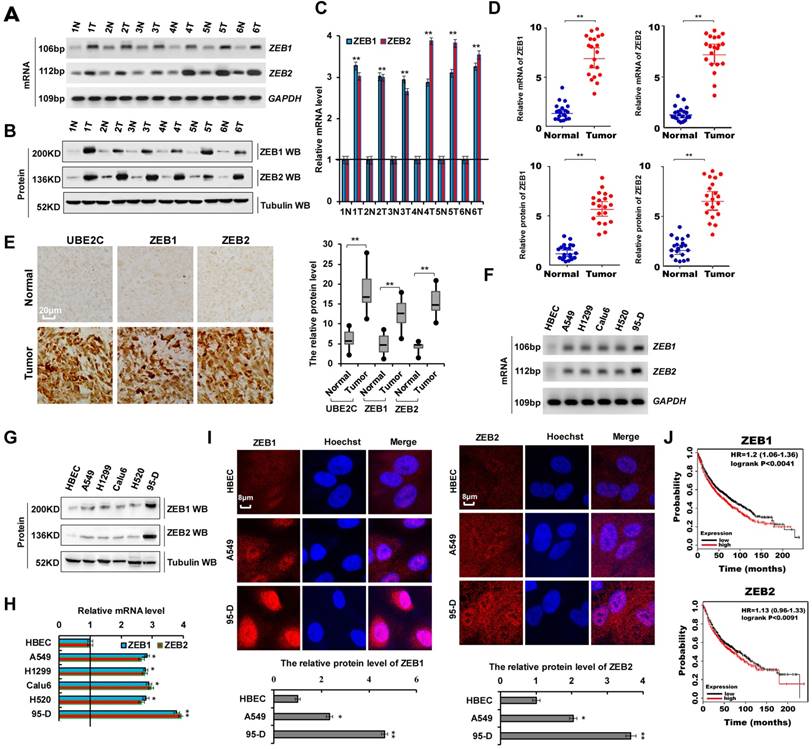 UBE2C, Directly Targeted by miR-548e-5p, Increases the Cellular Growth ...