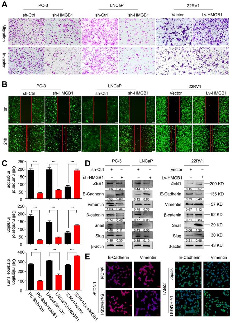 Hmgb1 Promotes Prostate Cancer Development And Metastasis By