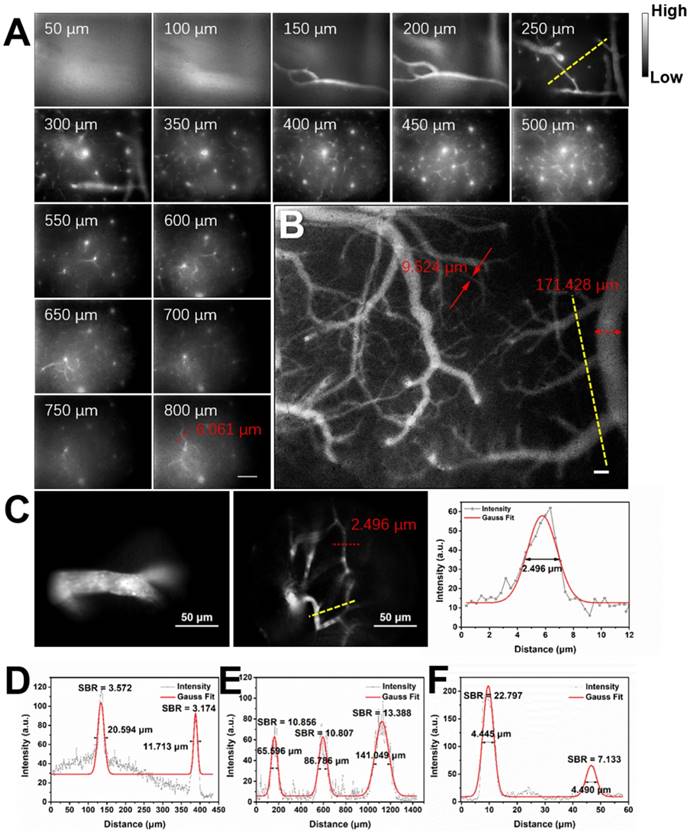 Theranostics Image