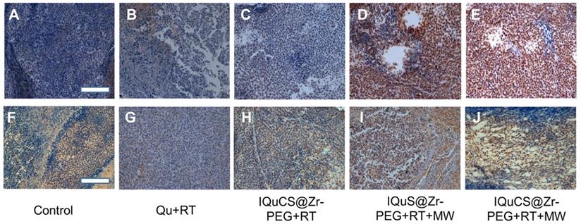 Tumor reoxygenation for enhanced combination of radiation therapy and ...