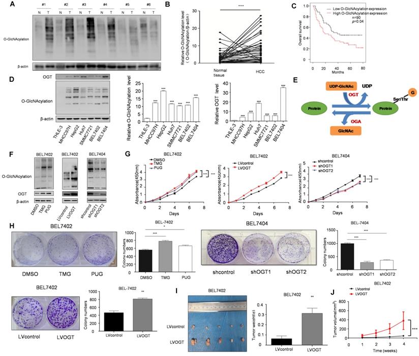 O-GlcNAcylation of SIX1 enhances its stability and promotes ...