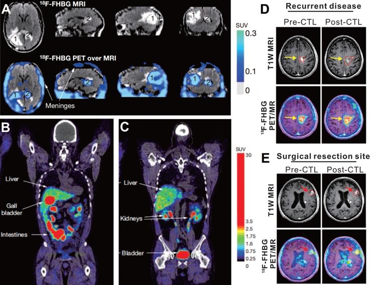 Theranostics Image
