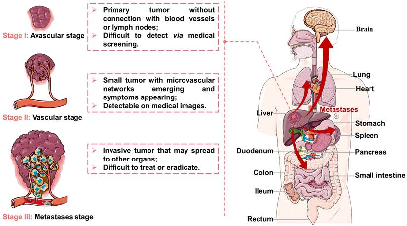 Theranostics Image