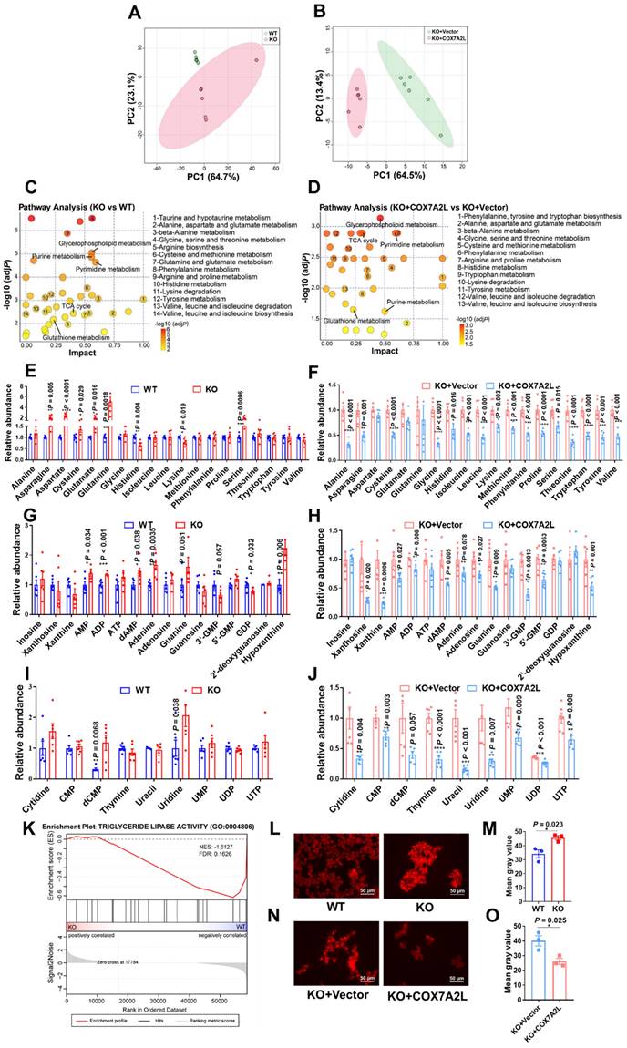 Mitochondrial supercomplex assembly regulates metabolic features and ...