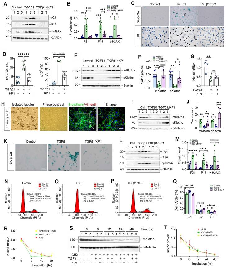 Klotho-derived peptide 1 inhibits cellular senescence in the fibrotic ...