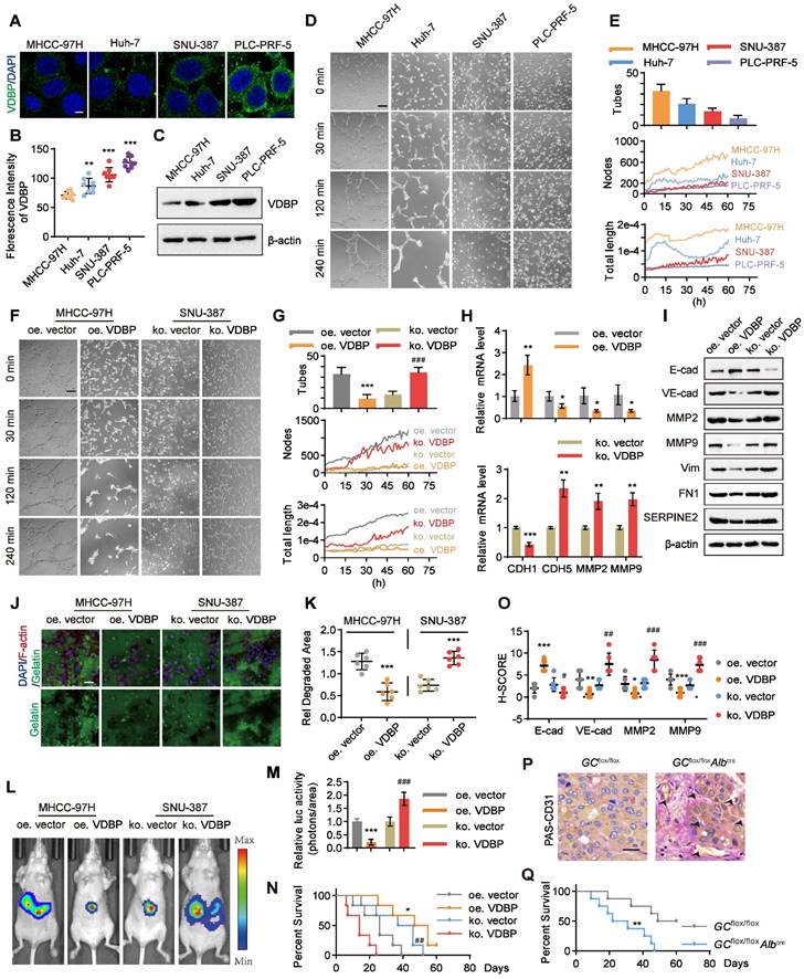 Vitamin D binding protein (VDBP) hijacks twist1 to inhibit vasculogenic ...