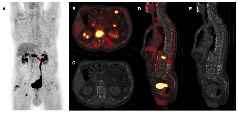 Theranostics Image