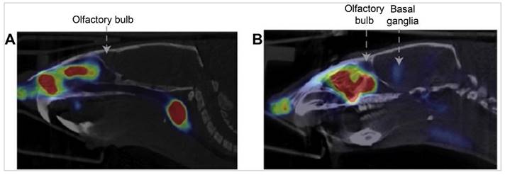 Theranostics Image