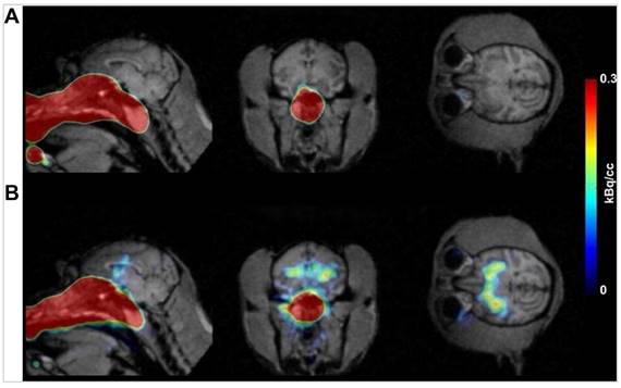 Theranostics Image