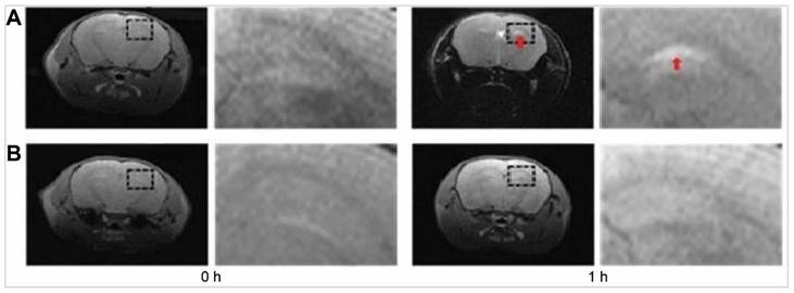 Theranostics Image