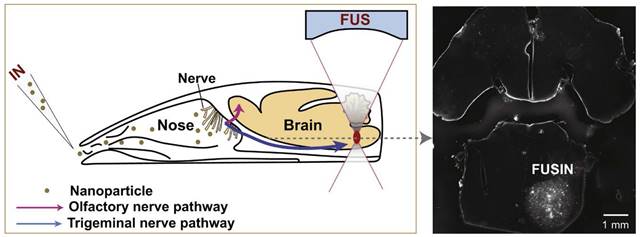 Theranostics Image