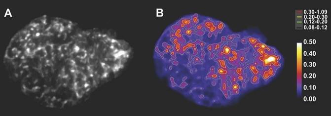 Theranostics Image