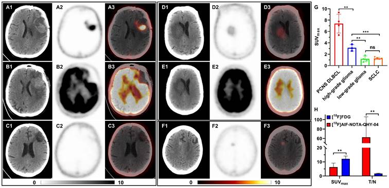 Theranostics Image