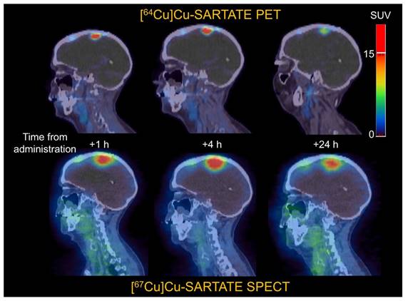 Theranostics Image