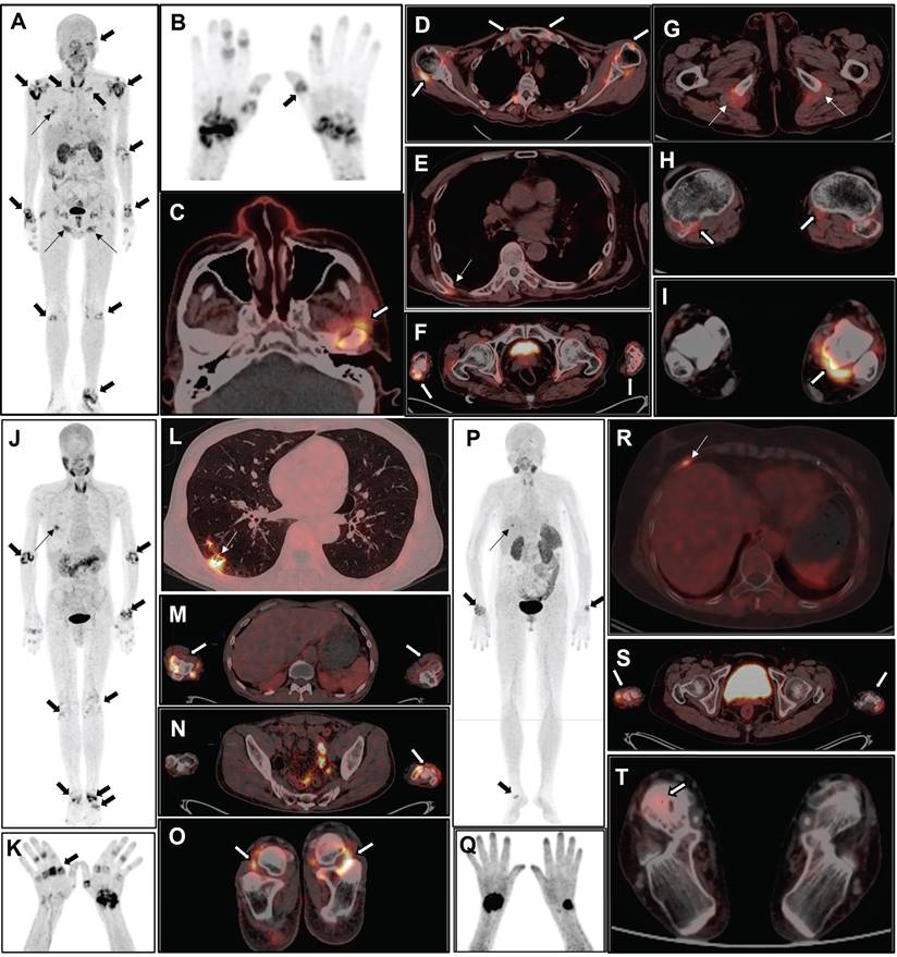 Theranostics Image