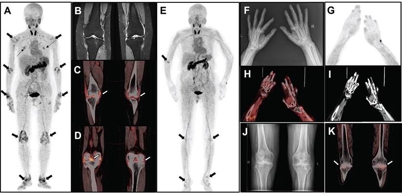 Theranostics Image