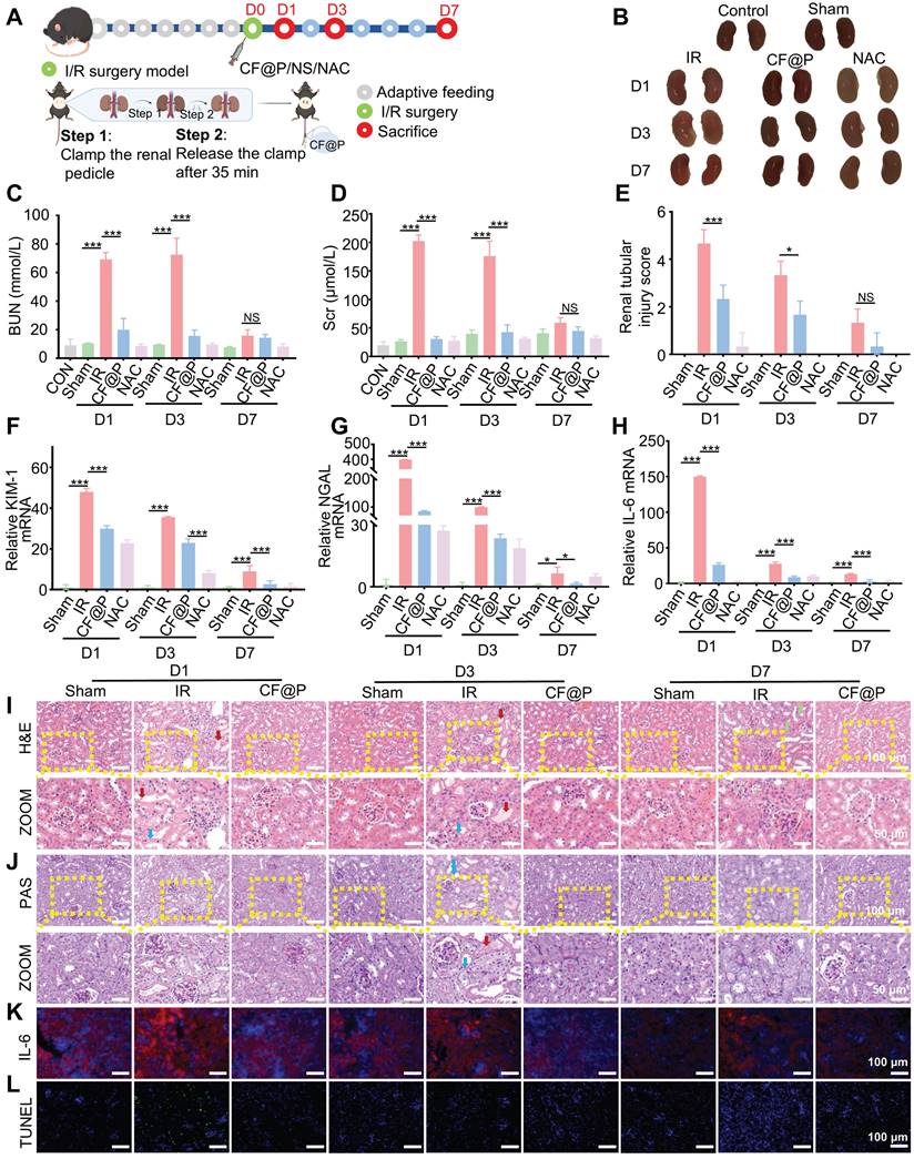 An enzyme-mimicking reactive oxygen species scavenger targeting ...