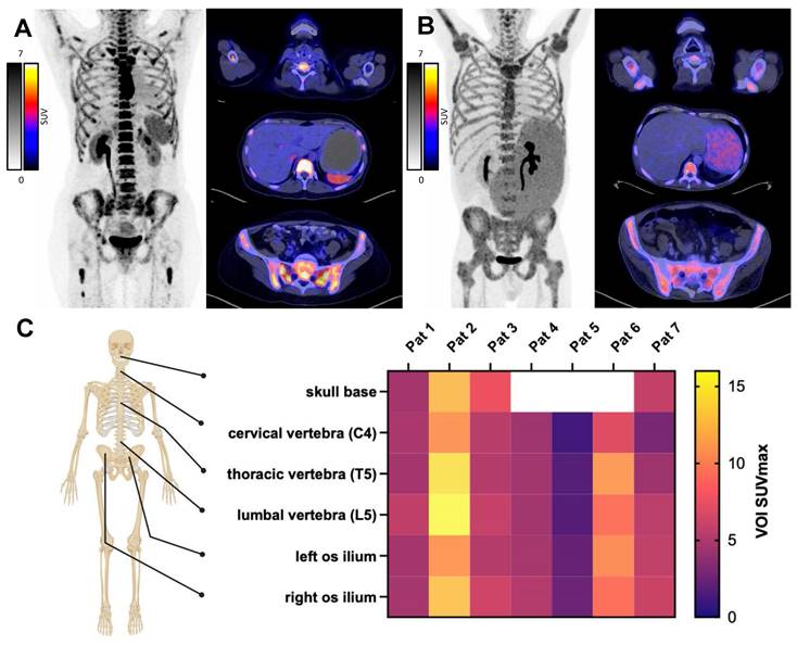 Theranostics Image