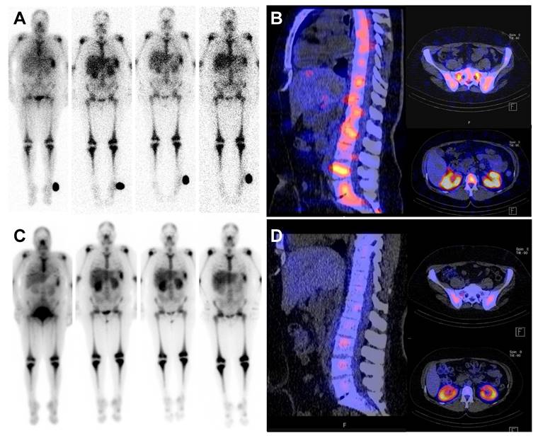 Theranostics Image