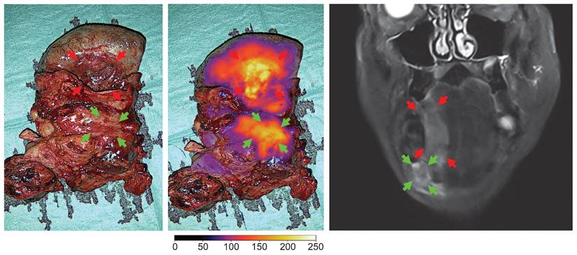 Theranostics Image