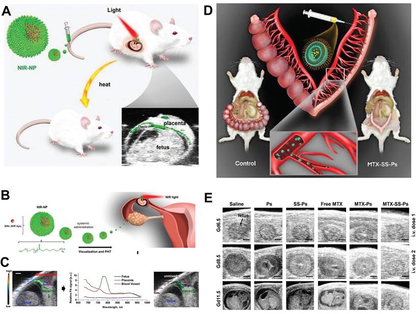 Theranostics Image