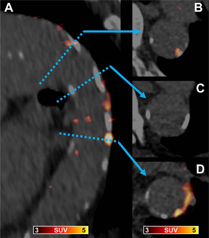 Theranostics Image