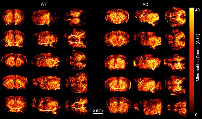 Theranostics Image