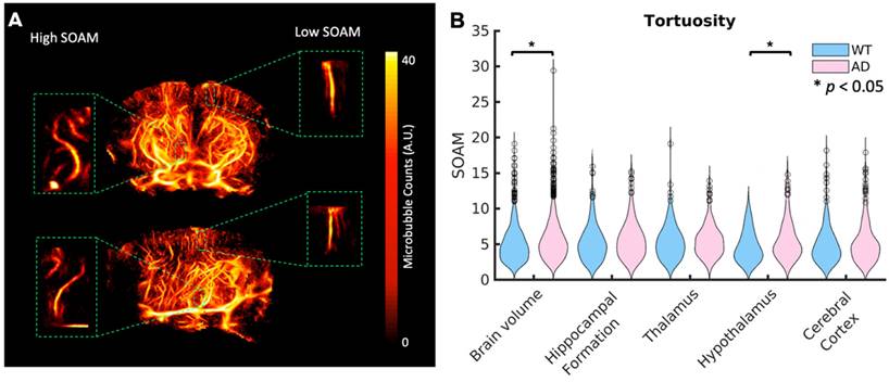 Theranostics Image