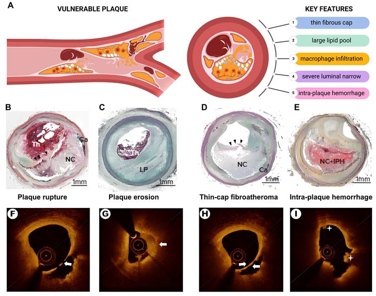 Theranostics Image