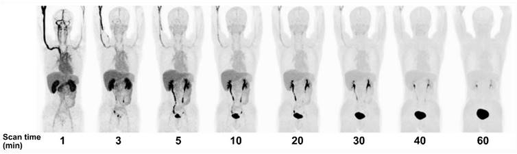 Theranostics Image