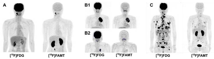 Theranostics Image