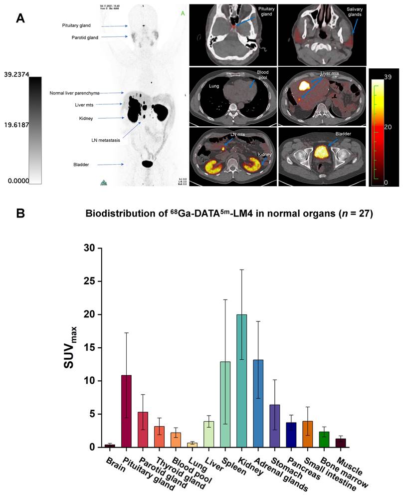 Theranostics Image