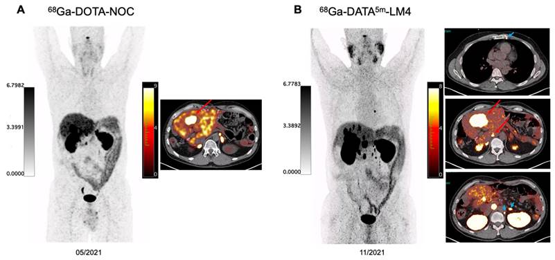 Theranostics Image