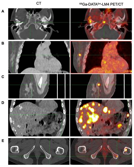 Theranostics Image