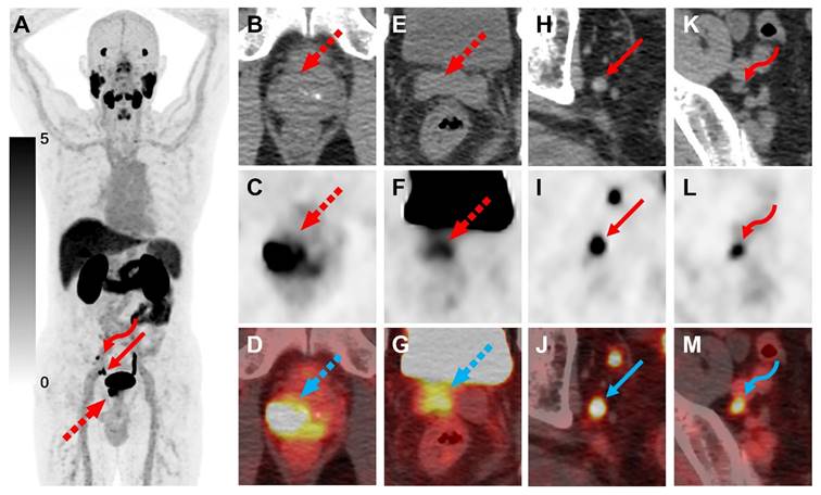 Theranostics Image