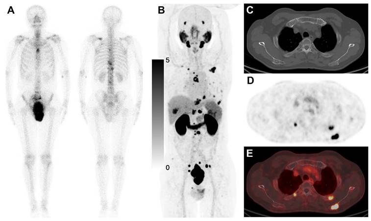 Theranostics Image