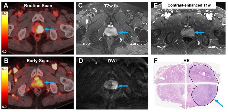 Theranostics Image