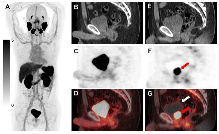 Theranostics Image