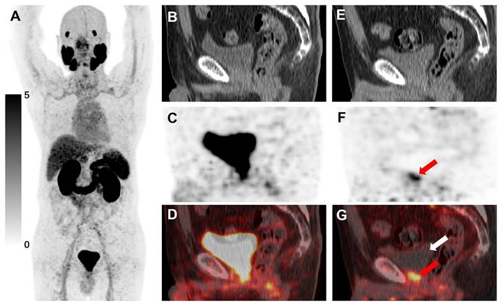 Theranostics Image