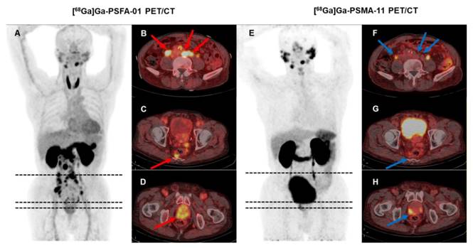 Theranostics Image